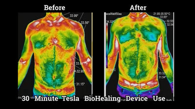 Tesla Medbed - Antes y después de la evaluación del termógrafo